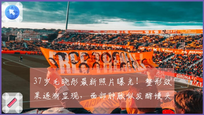 37岁毛晓彤最新照片曝光！整形效果逐渐显现，面部肿胀似发酵馒头